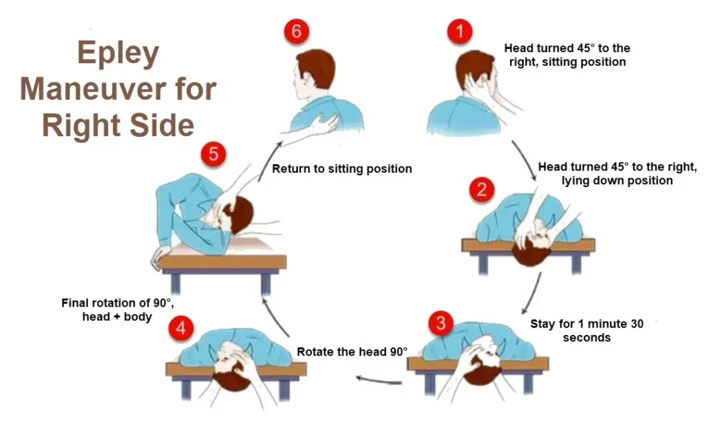 What Is the Epley Maneuver—And Can It Really Stop Vertigo? - ForthWorthHeadNeckandJaw